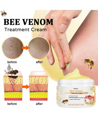 AAFQ Professional Bee Venom Treatment Cream 2024 Professional New Bee Venom Repair Cream Hydrating Moisturizing Treatment for Men&Women 1Fl Oz (1) - Buy Online on GoSupps.com