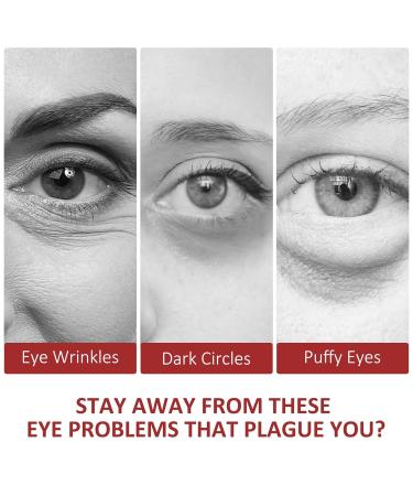 Boobeen Eye Cream Stick | Anti-Aging Eye Cream for Dark Circles Puffiness & Wrinkles - Buy Online on GoSupps.com