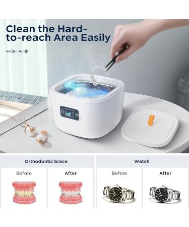 Wikay Ultrasonic Cleaner for Dentures, Retainers, Mouth Guards - Professional Dental Cleaner Machine - Portable & Electric - 255ML Capacity - Buy Online on GoSupps.com