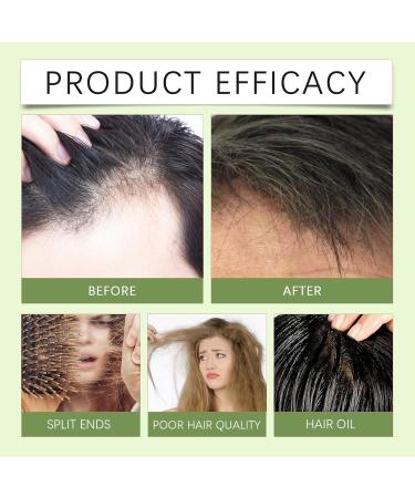 Shantou Youjia Rosmarin Festes Shampoo Bar 2pcs - Buy Online on GoSupps.com