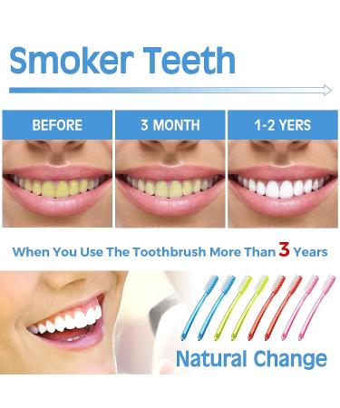 Zopeal Extra Hard Full Head Toothbrush - 12 Pack for Stain Removal & Teeth Whitening - Buy Online on GoSupps.com