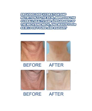 Moily Women Neck Cream 20 Gram Firming Hydrating Moisturizer Lifts Tightens Smooths Fine Lines Improves Skin Elasticity Lightweight Non Greasy White One Size One Size White - Buy Online on GoSupps.com