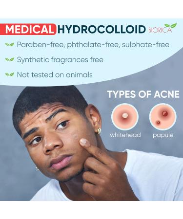 Acne Pimple Patches - 216 Hydrocolloid Zit Patches for All Skin Types - Invisible Healing Treatment - Buy Online on GoSupps.com