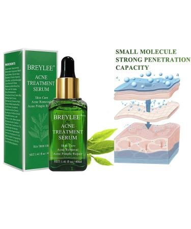 Tea Tree Acne Treatment Serum - Clear Severe Acne Breakouts & Repair Skin - 40ml (1.41fl oz) - Buy Online on GoSupps.com