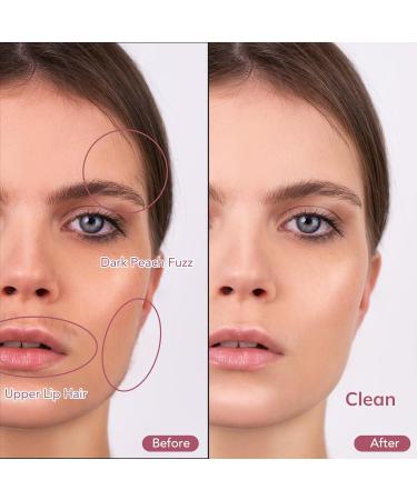 PELCAS Electric Dermaplaning Tool Kit with LED Light - Painless Mini Face Razor 6 Replaceable Blades 3 Speeds for Exfoliation & Hair Removal - Perfect for Women BV18-712 - Buy Online on GoSupps.com