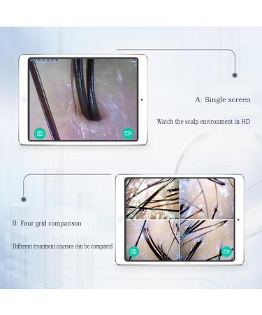 Wireless Skin and Hair Tester Follicle Analyzer with Manual Focusing and High-Speed Video Processing Chip Scalp Detector WiFi Hair Salon Equipment - Buy Online on GoSupps.com