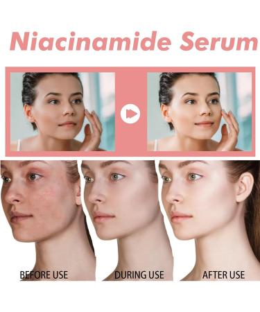 Peach 70 Niacin Serum 70% Peach Niacinamide Serum Dark Spot Correcting Glow Serum Hydrating Face Serum for smoother & glower Skin Texture in Spot-prone Skin Face Serum for Women For Dull Tired Skin - Buy Online on GoSupps.com