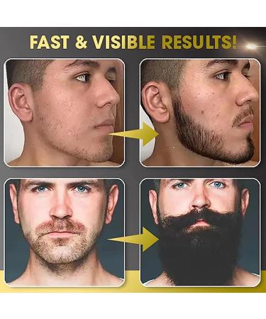 ExQst BeardMax Organic Oil - All Natural Beard Growth Serum for Men | 2PCS Bart l for Fuller Beards - Buy Online on GoSupps.com