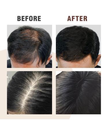 5-in-1 Herbal Hair Thinning Shampoo | 100% Natural Organic Hair Wash for Men & Women | Ginger Ginseng & Polygonum Multiflorum Infused | Daily Hair Care Treatment - Buy Online on GoSupps.com