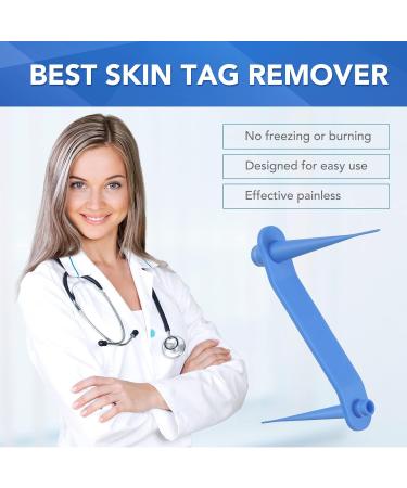 Skin Tag & Mole Remover Kit - Safe & Painless Removal for Small to Large Skin Tags (2mm-8mm) - Buy Online on GoSupps.com