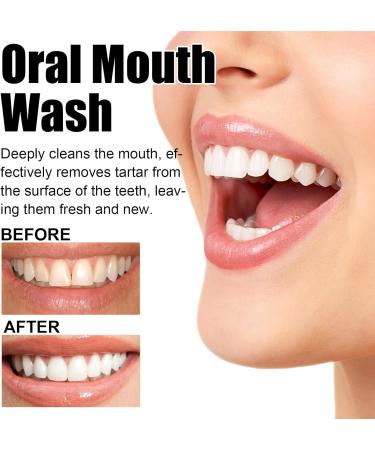 KLYso Advanced Oral Care Foaming Toothpaste - Teeth Whitening Tartar Removal Bad Breath Control & Enamel Protection(3PCS) - Buy Online on GoSupps.com
