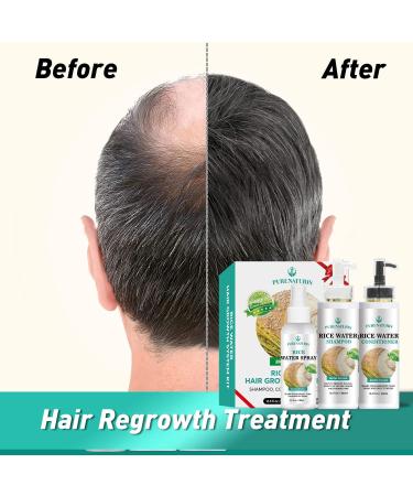 Shampoo Conditioner & Serum Set | Fermented Rice Water & Biotin | Hair Growth Repair Kit | Sulfate Free Vegan All Hair Types - Buy Online on GoSupps.com