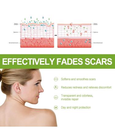 Goopgen Advanced Scar Repair Serum - Intensive Scar Treatment (1PC) - Buy Online on GoSupps.com