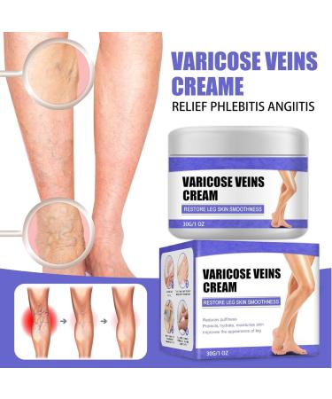 Cream against spider veins for effective treatment of varicose veins Treatment Legs Cream soothes and moisturizes quickly - Buy Online on GoSupps.com