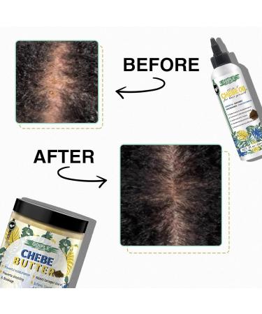 Chebe Hair Growth Oil & Butter - Deep Moisturization for All Hair Types | 8.8oz | Men & Women - Buy Online on GoSupps.com