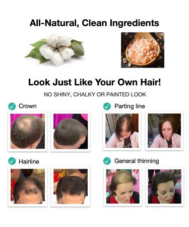 Caboki Plant-Based Hair Concealer - Covers Bald Spot & Thinning Hair - Black (16G) - Buy Online on GoSupps.com