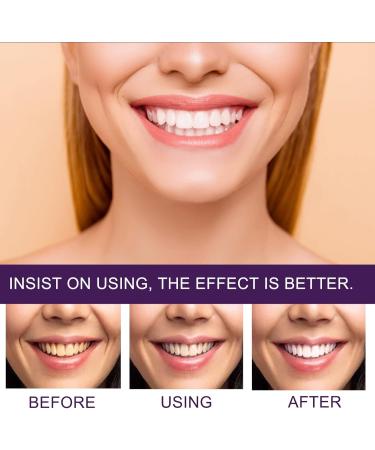 KLYso Professional Teeth Whitening & Stain Remover Toothpaste - Remove Stains Prevent Pigmentation Brighten Yellow Teeth(3PCS) - Buy Online on GoSupps.com
