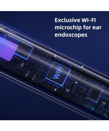 Smart Visible Ear Cleaner | Ear Wax Removal Tool with 10MP HD 360 Degree Wide Angle Ear Scope | Earwax Remover (White) - Buy Online on GoSupps.com