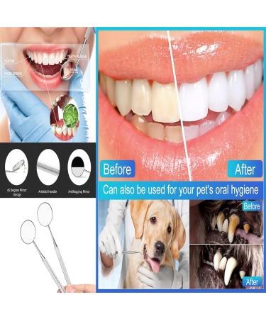 Premium Stainless Steel Dental Mirror - Mouth Inspection Tool | 1 Piece Pack for Dentists - Buy Online on GoSupps.com