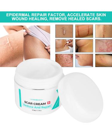 Scar Removal Cream - Pregnancy, Acne, Facial & Skin Repair Treatment Gel - Buy Online on GoSupps.com