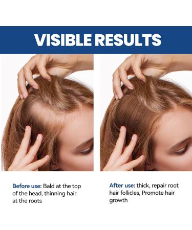 Hair Growth Serum Spray Thinned Hair Liquid Grow Hair Natural Hair Density Essential Oil Hair Growth Oil for Hair Rapid Growth and Thickening Trengthen Hair Roots Gifts for Men and Women - Buy Online on GoSupps.com