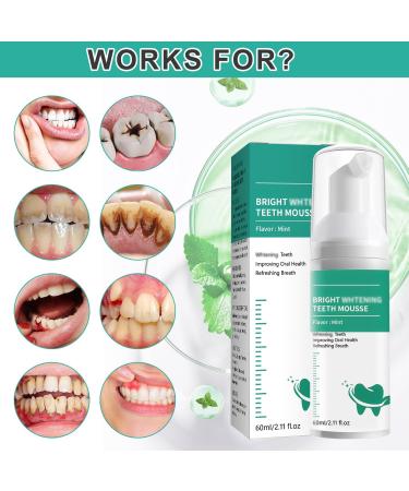 Whitening Teeth Mousse Foaming Toothpaste - Brightening & Deep Cleaning Formula | Ultra-fine Stain Removal Mousse (2PCS) | Refreshing Oral Repair Foam - Buy Online on GoSupps.com