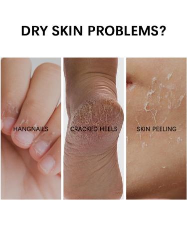  Chaies Foot Balm Stick | Moisturizing Repair Butter | Cream for Dry and Cracked Hands and Feet - For Dry Rough Cracked Knees Elbows and Body - Daily Use - Morning and Night - Winter - For Men and Women - Buy Online on GoSupps.com