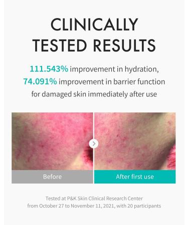 REJURAN Moisture Treatment Ampoule c-PDRN - Deep Hydrating Face Serum for Instant & Long-Lasting Moisture Soothing Skin Barrier Boost Moisture Lock with PDRx. Korean Skin Care (1.01 fl oz) - Buy Online on GoSupps.com