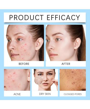 Brightening Cream for Face 20g Pimple Moisturizing Cream Moisturizing Rejuvenating Soothing Cream For Women Daily Use Night Day And Home - Buy Online on GoSupps.com