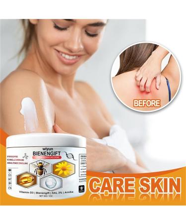Todahof Bee Venom Psoriasis Treatment Cream Bee Venom Psoriasis Treatment Cream Todahof Bee Venom Relief Cream Todahof Bee Venom Ointment Psoriasis Cream 30 g (3 Pieces) 3pc - Buy Online on GoSupps.com