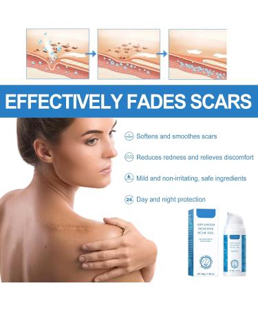Silicone Scar Gel - Scar Removal Cream - 30g Scar Cream - Scar Removal and Soothing Cream for Surgical Scars Acne Scars C-Section Burns Stretch Marks - Effective for Old and New Scar - Buy Online on GoSupps.com