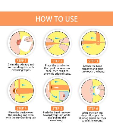 MEIJU Skin Tag Removers | 2-in-1 Removal Kit for Small to Large Skin Tags | Easy Application Device with 36 Repair Patches - Yellow - Buy Online on GoSupps.com