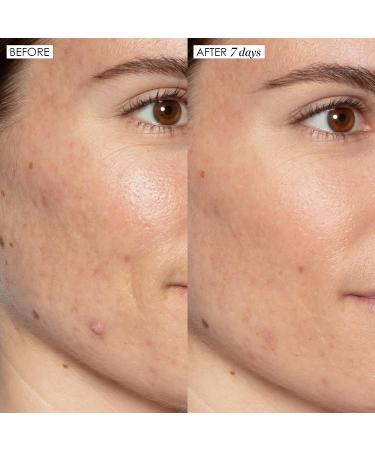 Sunday Riley Good Genes Lactic Acid Treatment Serum 1 Fl Oz - Skin Care Must-Have - Buy Online on GoSupps.com