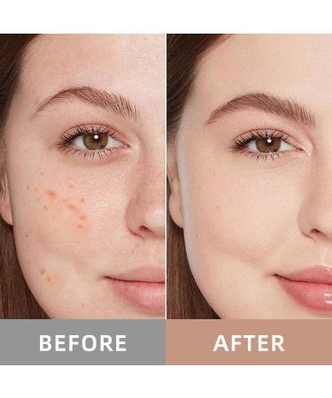 UWPU Facial Oil - Moisturizing Rose Oil Formula Non-Greasy Skincare for Redness Relief & Improved Texture | 30ml - Buy Online on GoSupps.com