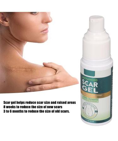 Scar Gel 50ml - For Burn, Surgical, Cesarean, Stretch Marks & Toenail Clippers - Old & New Scar Removal Cream - Buy Online on GoSupps.com