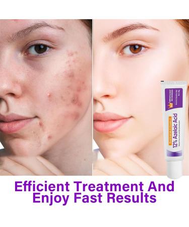 Azelaic Acid Cream 1PCS Azelaic Acid for Face 12% with Hyaluronic Acid & Niacinamide Azelaic Acid Gel for Reducing Blemish & Rosacea Acne Moisturizing & Balance Sebum for Sensitive Skin(0.7 Ounce) 1 Ounce (Pack of 1) - Buy Online on GoSupps.com