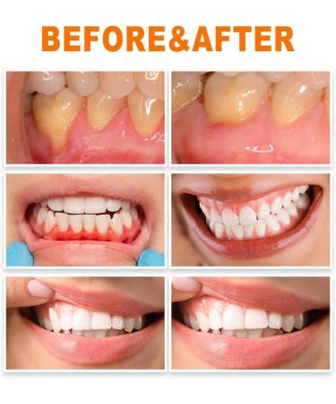  EXQST Cvreoz Gum Repair Essence Blister Tooth Blister Essence for tartar removal - Buy Online on GoSupps.com