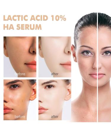 10% Lactic Acid Serum with Hyaluronic Acid & Vitamin C | Shrink Pores Hydrate & Even Skin Tone - Buy Online on GoSupps.com