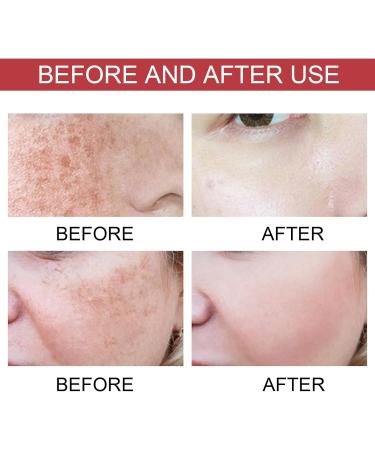 Lot de 2 cr mes claircissantes l'acide kojique pour le visage cr me hydratante et claircissante pour le visage anti-rides et raffermissante hydratante - Buy Online on GoSupps.com