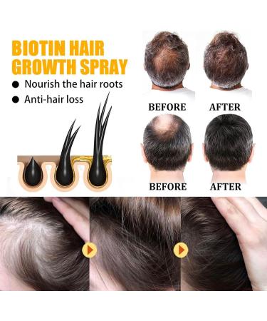 KiJalyelu Biotin Fast-growing Hair Essential Oil for Hair Loss Biotin Roll-On Oil for Thin Hair Hydrating & Nourishing Anti Hair Growth Serum Fuller and Faster Growing Hair - 30ml (1PC) - Buy Online on GoSupps.com