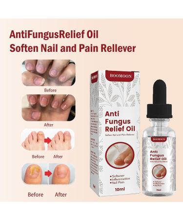  Saiki Toenail Oil for Growth and Strength Nail Repair Solution for Thick Broken & Discolored Nails | Solution for Bleached Damaged Nails 10ml Nail Care Repair Oil Nourish Saiki - Buy Online on GoSupps.com