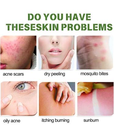 Tea Tree Face Wash Tea Tree Acne Face Wash Facial Wash with Tea Tree Oil Tea Tree Foaming Cleanser For Acne Tea Tree Natural Face Wash for Reduces Acne & Exfoliating & Pimples Wash for All Skin Types - Buy Online on GoSupps.com