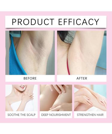 Shantou Youjia strawberry hair removal essential oil - Buy Online on GoSupps.com