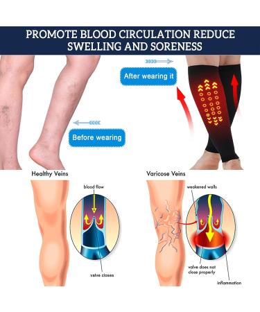Tbusingoto Medical Compression Stockings for Men & Women - 2 Pairs Thrombosis Protection 20-30 mm Hg Ideal for Varicose Veins & Pregnancy Swelling - XXL Black - Buy Online on GoSupps.com