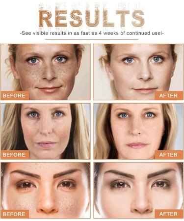 Buy Anti Wrinkle Peptide Serum - Anti Aging Face Tightening Cream for Fine Lines & Wrinkles | Hydrating Peptide Formula for Youthful Skin - Buy Online on GoSupps.com