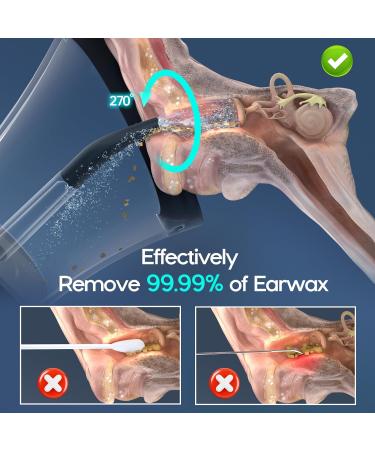 Morfone Ear Wax Removal Kit - One-Handed 4 Modes IPX6 Waterproof 6 Nozzle Cleaner for Adults & Kids - Safe & Effective Ear Care - Buy Online on GoSupps.com