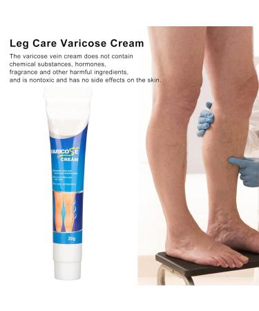 Varicose Veins Cream | Eliminate Spider Veins & Soothing Treatment - International Shipping - Buy Online on GoSupps.com