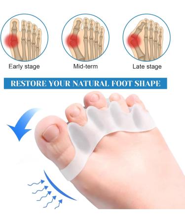 4-Piece Silicone Toe Spreader & Separator | Hammer Toe Correction for Hallux Valgus | Unisex Transparent Design - Buy Online on GoSupps.com