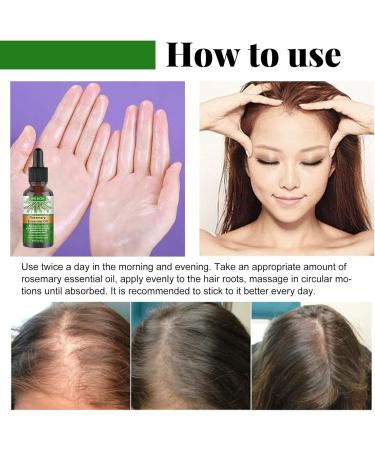 Shenrongtong Rosemary Oil for Hair Growth Rosemary Oil for Hair 30ML Organic Hair Serum to Nourish Scalp and Stimulate Hair Growth - Buy Online on GoSupps.com