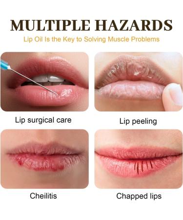 Honey Moisturizing Lip Oil Honey Moisturizing Lip Oil Moisturizing Lip Gloss Cracked Lip Care Oil Nourishing and Repairing Lip Lines Non-Sticky Hydr - Buy Online on GoSupps.com